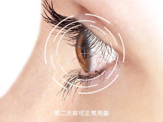 恢复快.jpg 恢复快.jpg